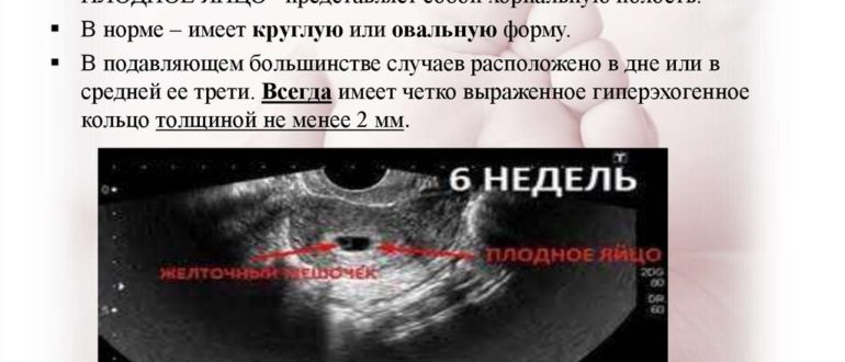 Отслойка на ранних сроках