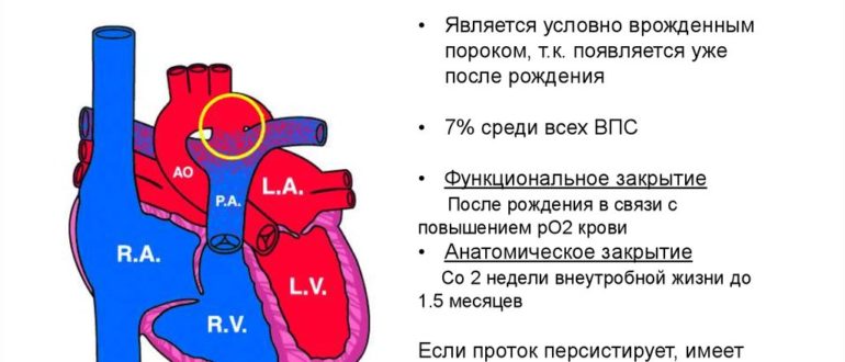 Опасно ли ОАП 5мм у ребёнка 13 лет