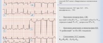 Нужно улучшить экг