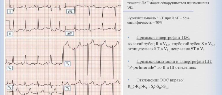 Нужно улучшить экг