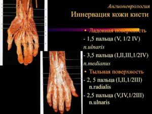 Гиперпараестезия 4 и 5 пальца левой кисти в районе иннервации n. Ulnaris