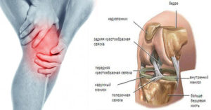 Ноющая боль в коленном суставе