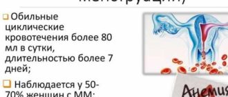 Обильные месячные-анемия