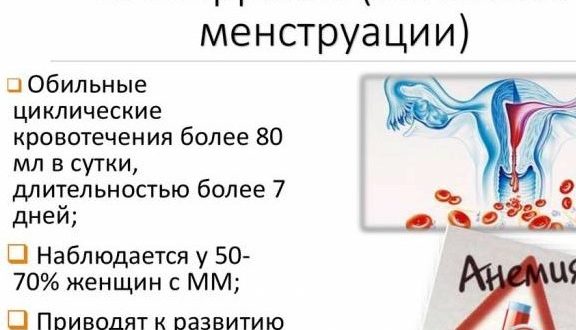 Обильные месячные-анемия