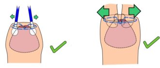 Головка открывалась, а теперь нет. Почему?