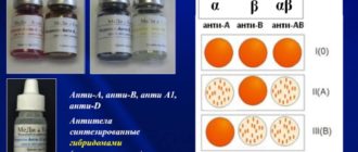 Окр от анти-а паксила становится тяжелее