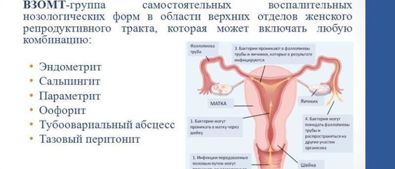 Хр. эндометрит и различные тепловые воздействия на область малогт таза