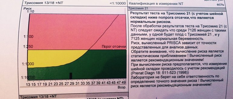 Нормальные ли результат теста на Трисомию 21