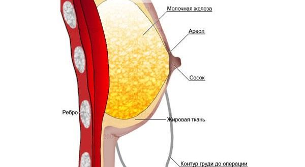 Грудь стала мягкой в 19 лет