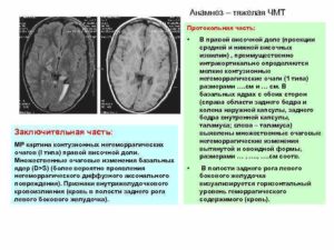 О чем говорят негрубые фокальные нарушения слева в теменно-центрально-височной доле?