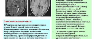 О чем говорят негрубые фокальные нарушения слева в теменно-центрально-височной доле?