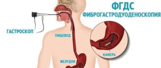 Фгдс и алкоголь