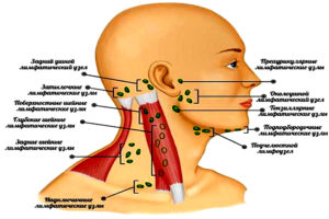 Переднешейный лимфоузел