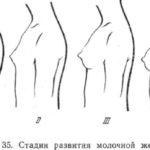 Парень решил расстаться