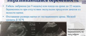 Ошибка в сроке или замершая беременность