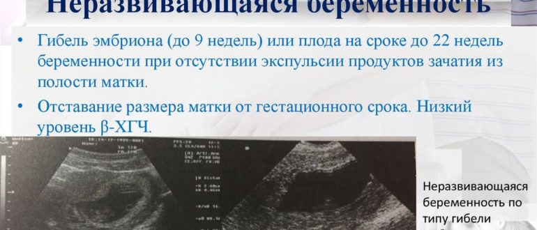 Ошибка в сроке или замершая беременность
