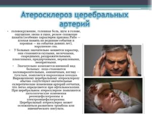 Головные боли, шум в ушах. Атеросклероз