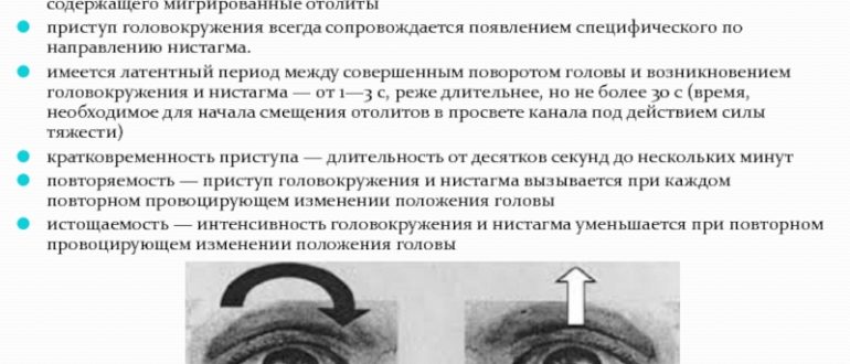 Головокружение при повороте с бока на бок?