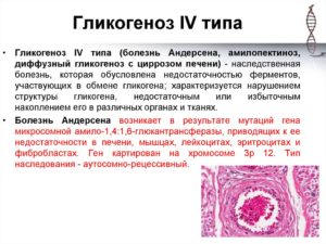 Гликогеноз 4 типа