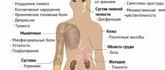 Фибромиалгия