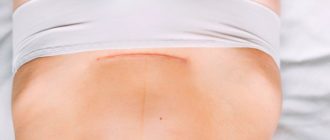 Не регулярные месячные после кесарева