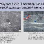 Генетический анализ крови первый скрининг