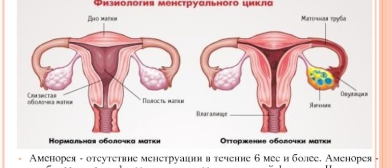 Отсутствие месячных 4 месяца