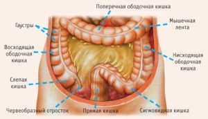 Образование ободочной кишки