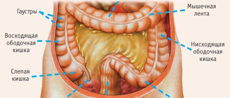 Образование ободочной кишки