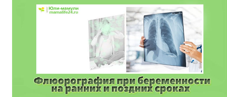 Флюорография на ранних сроках беременности