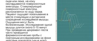 Описание ЭНМГ