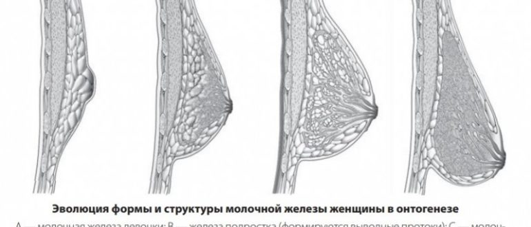 Форма груди