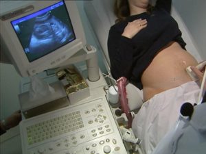 Новая беременность после медикаментозного аборта
