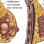 Голуби, голуби, уберите голубей, я их боюсь