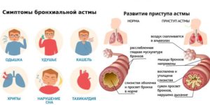 Головокружение, одышка, кашель, пульс до 80, температура 37