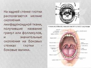 Образование на задней стенке глотки