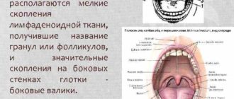 Образование на задней стенке глотки