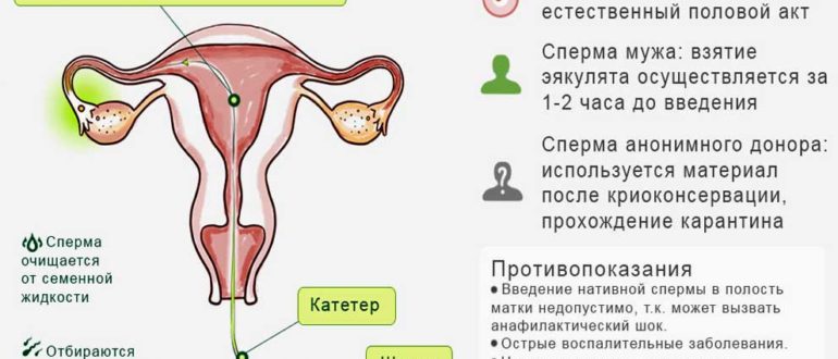 Незащищённый секс с попаданием спермы при начале приема Джес