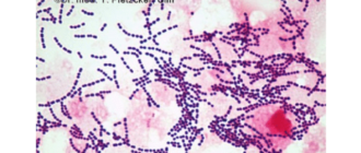 Neisseria sicca 10в6, streptococcus viridans group 10в6. haemophilus paranfluenzae 10в6