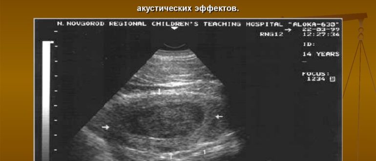 Очаговое образование правой почки