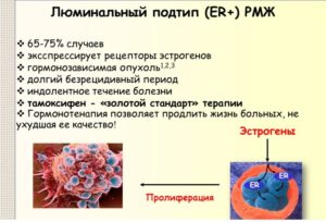 Гормонозависимый рак мж, стоит ли соглашаться на овариэктомию