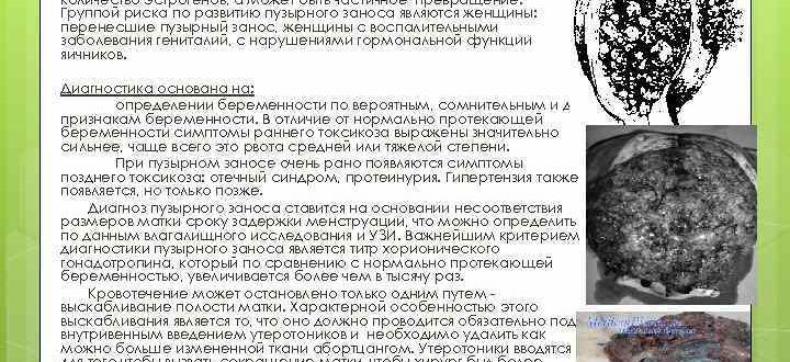 Фиброз ворсин хориона