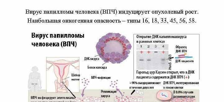 Хроническая болезнь матки, вирус паппиломы высокого онкогенного риска, эндометриоз