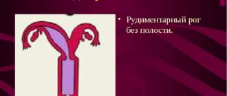 Однорогая матка
