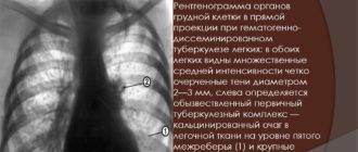 Описание рентгеновского снимка