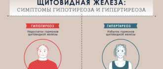 Гиперактивность щитовидной железы