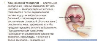 Ослабление иммунной системы, хронический тонзиллит, сыпь на теле