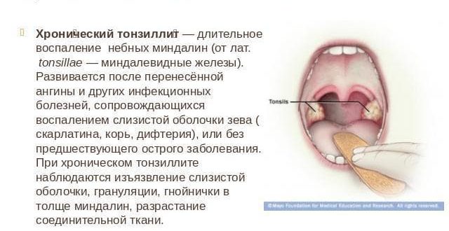 Ослабление иммунной системы, хронический тонзиллит, сыпь на теле