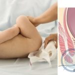 Недавно образовались шрамы на щеке