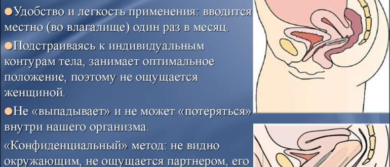 Новаринг и половой акт